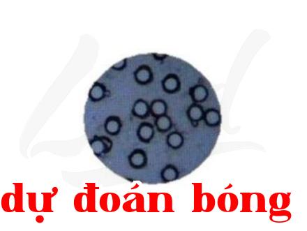 Giới thiệu công nghệ mới về xét nghiệm ung thư bàng quang bằng phương pháp tế bào thủy tinh